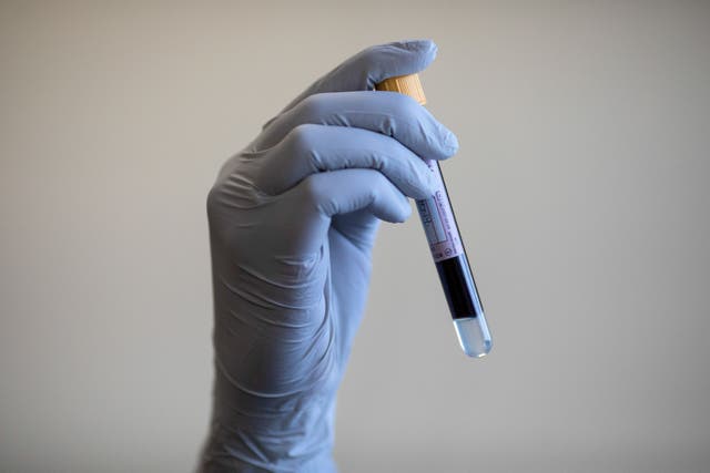 <p>A blood test can reveal the presence of prostate cancer</p>