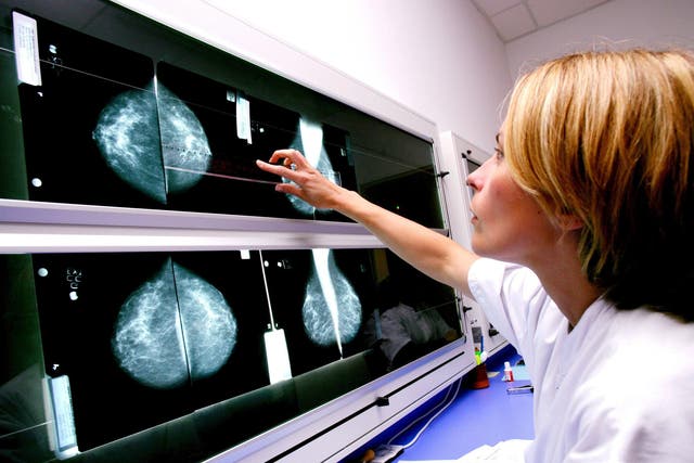 <p>Some patients treated with Enhertu saw their tumours disappear to the point where there was no cancer visible on scans</p>
